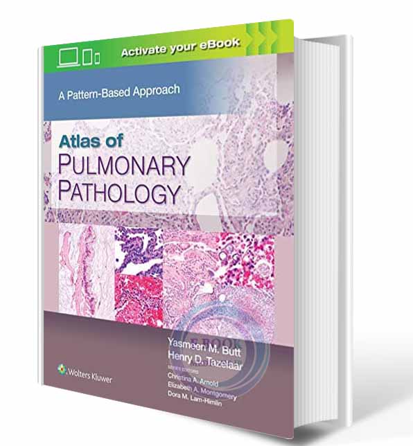 دانلود کتاب Atlas of Pulmonary Pathology: A Pattern Based Approach 2021  ( PDF)